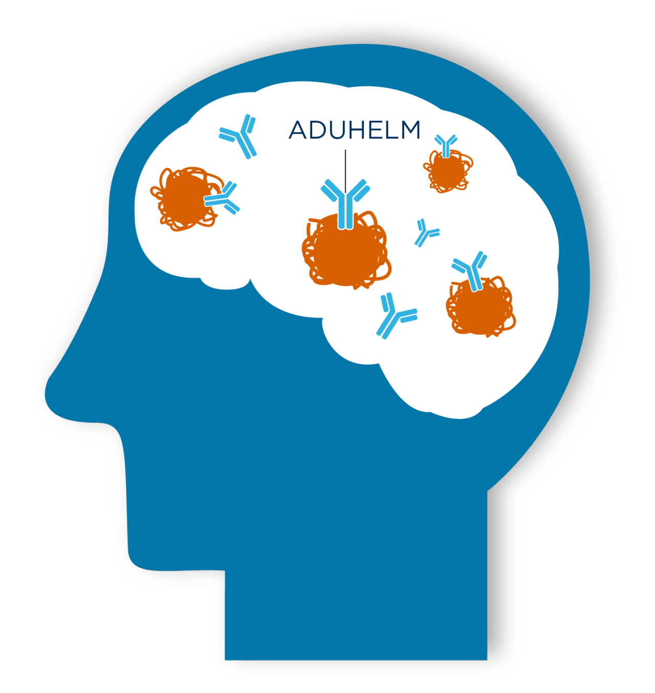 Illustration representing ADUHELM binding to amyloid plaques in the brain